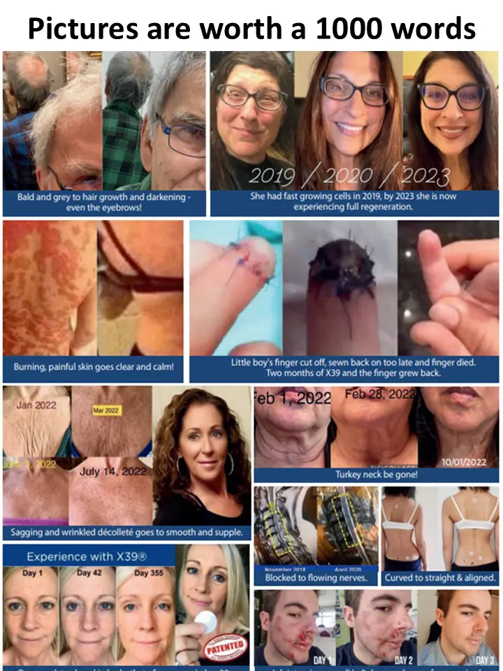 1000 words Before and Afters picture worth a 1000 words Wellness at LED Skin Care Spa