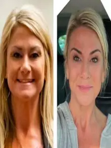 Age Revering - LED Skin Care Spa