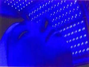 Blue LED Light for Acne Treatments