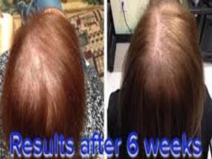 6-weeks of hair growth