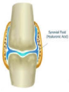 HA Joint Synovial Fluid