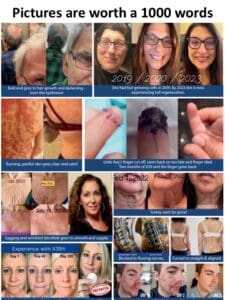 Wellness at LED Skin Care Spa