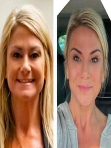 Age Revering - LED Skin Care Spa